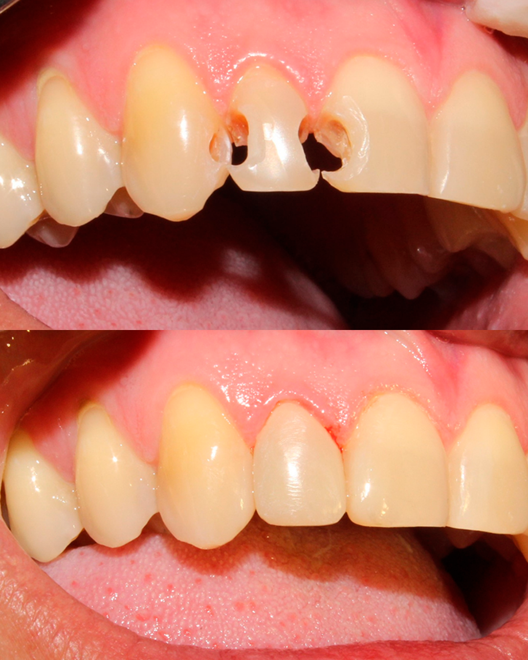 Harmonização do Sorriso